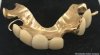 Churchill Dentures.jpg